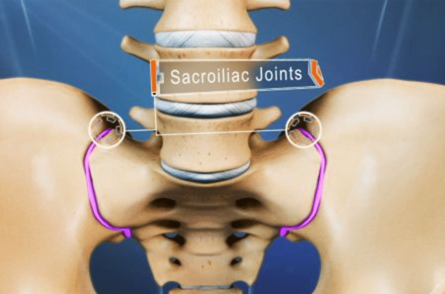 sacroiliac joint illustration