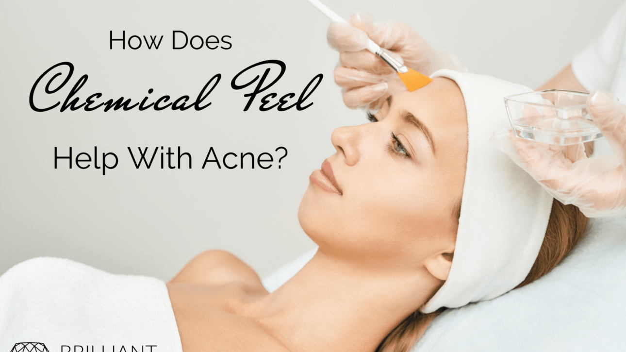 girl having a chemical peel applied using a yellow brush:text: how does chemical peel help with acne?