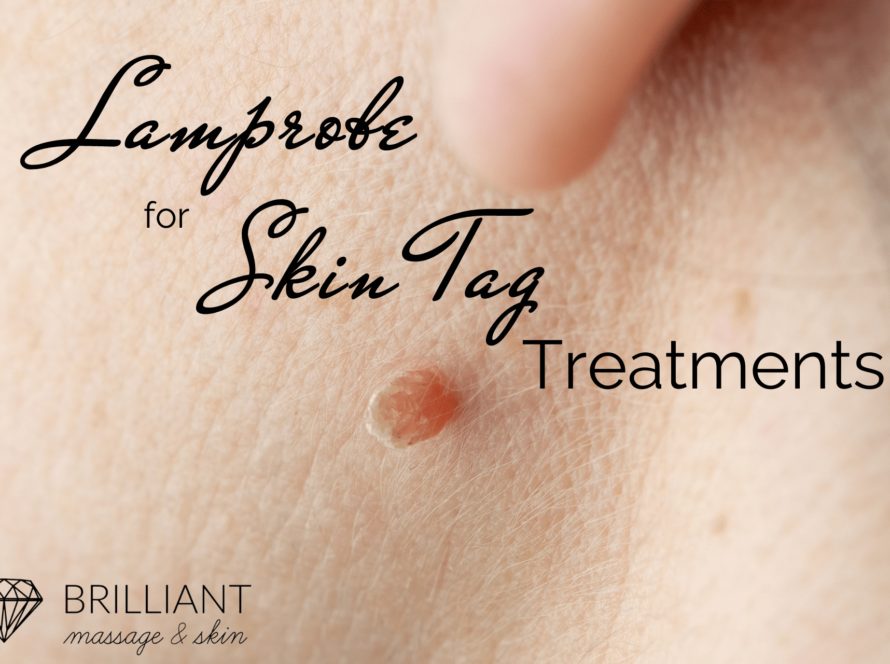 skin tag: text: lamprobe for skin tag treatments