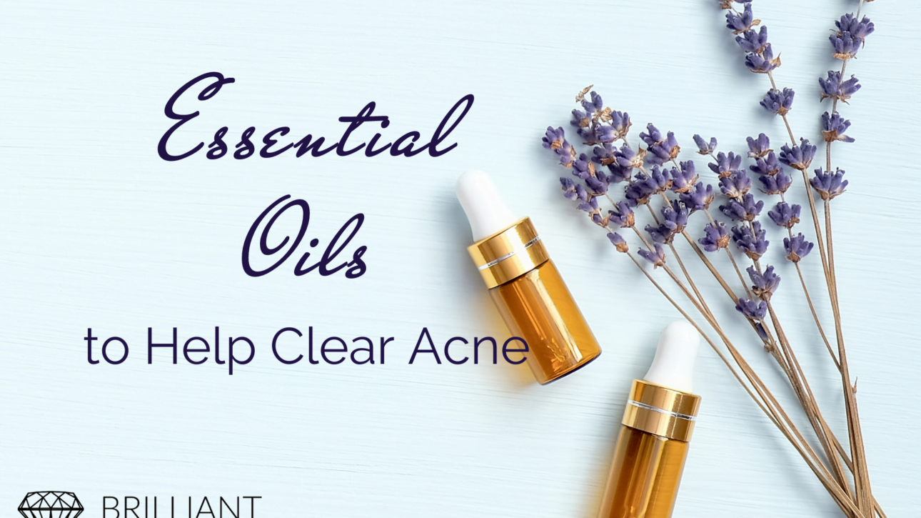 Essential oils in a bottle and some lavender flower; text essential oils to help clear acne