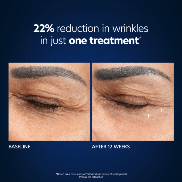 Hyaluronic Acid Microneedle Eye Patches (Box) - Image 5