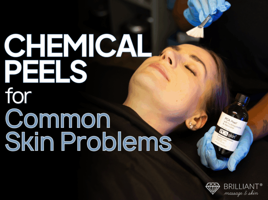 A client having a chemical peel while the esthetician is holding a PCA chemical peel bottle: text: chemical peels for common skin problem