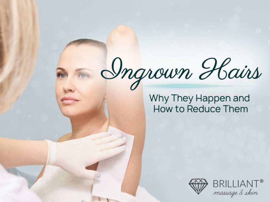 a girl having an underarm wax: text: Ingrown Hairs, Ehy they happen and how to reduce them